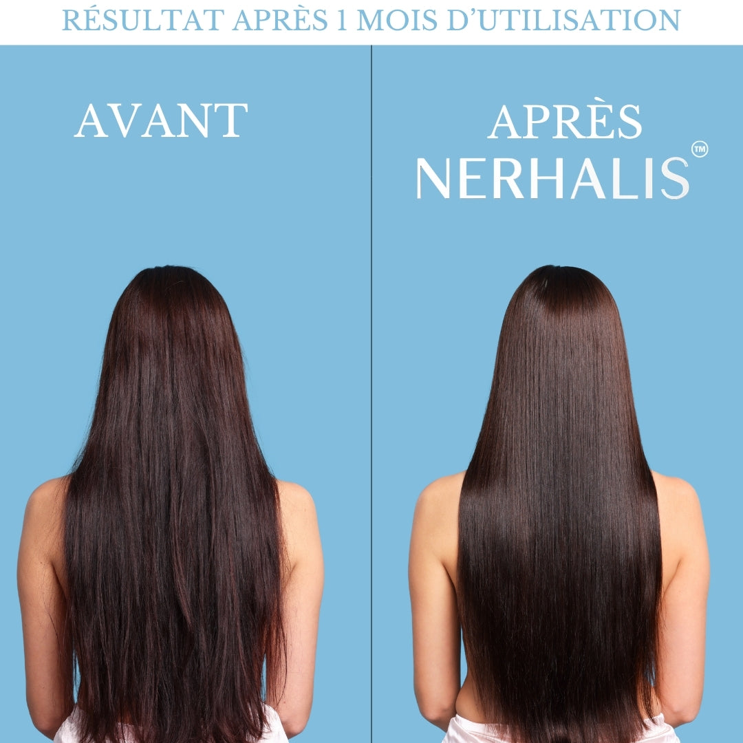 Pommeau de Douche Nerhalis™