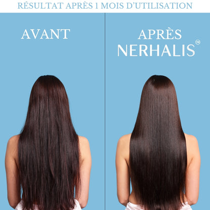 Pommeau de Douche Nerhalis™