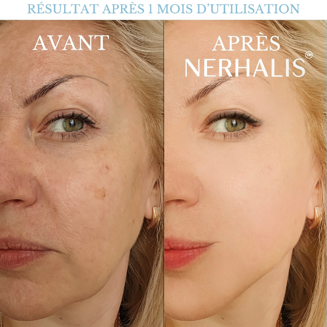 Pommeau de Douche Nerhalis™