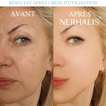 Pommeau de Douche Nerhalis™